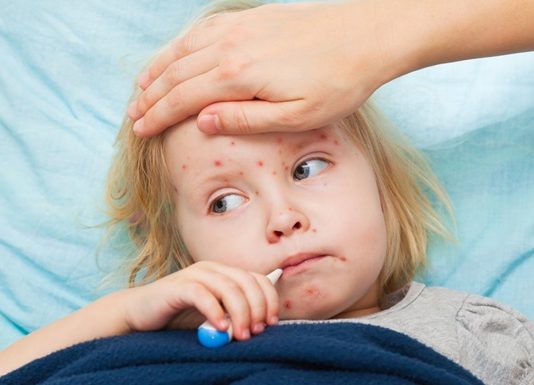 Кір в Україні: медики озвучили сумну статистику
