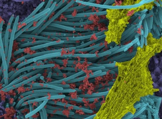 Вчені показали вражаючі знімки клітин, заражених SARS-CoV-2