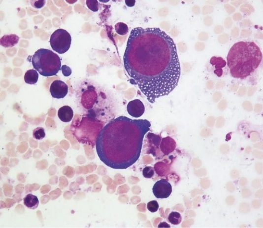 Парвовирус В19: симптомы и лечение